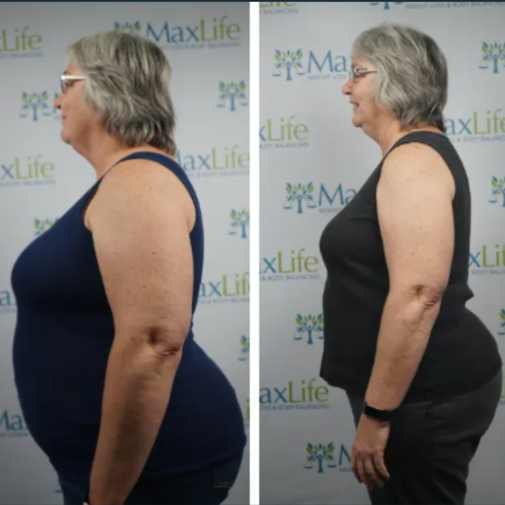 Linda — 27 lbs in 30 days at MaxLife Overland Park