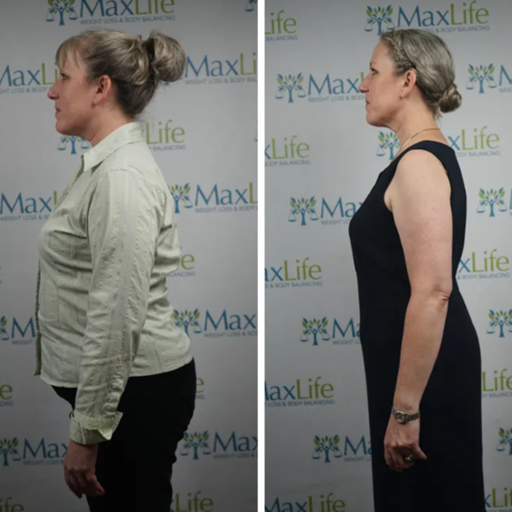 Sarah — 18 lbs in 30 days at MaxLife Overland Park