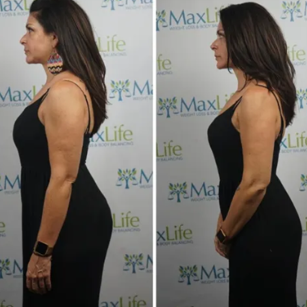 Maria — 22 lbs in 30 days at MaxLife Overland Park